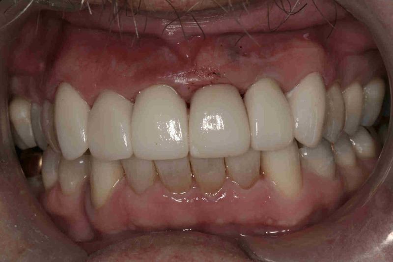 patient's after before dental treatment
